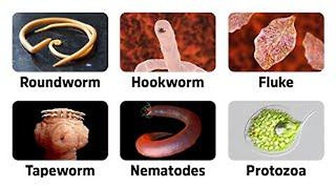 9 Warning Signs of Parasites -Dr. Berg