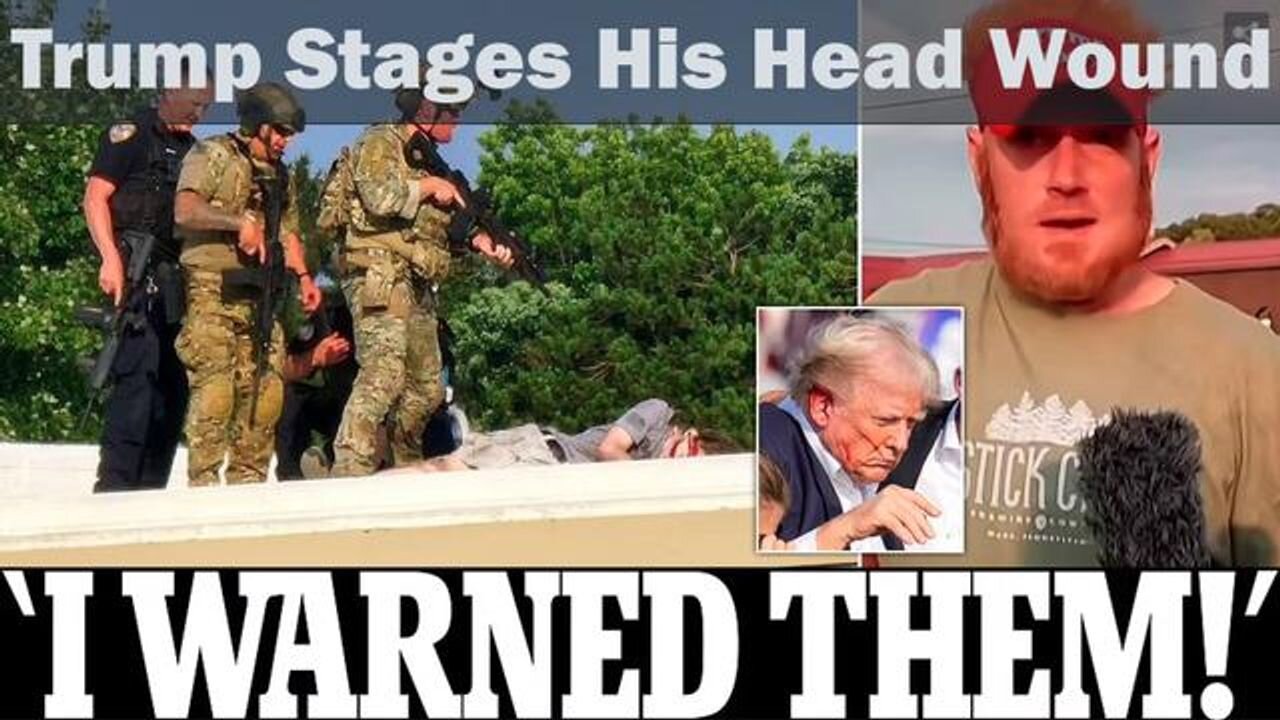 TRUMP STAGES HIS HEAD WOUND