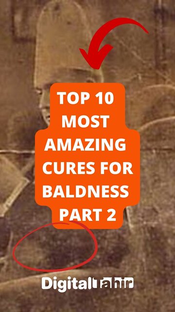 Top 10 Most Amazing Cures For Baldness Part 2