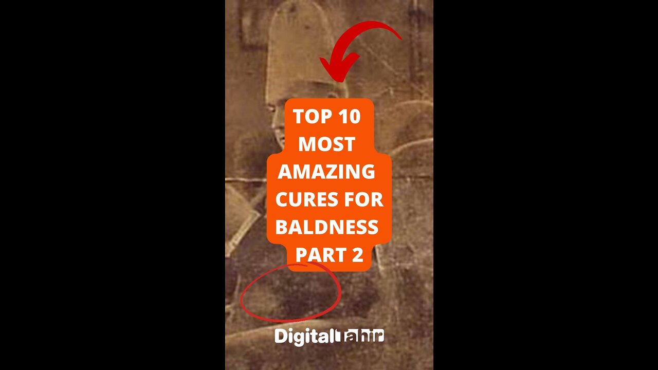 Top 10 Most Amazing Cures For Baldness Part 2