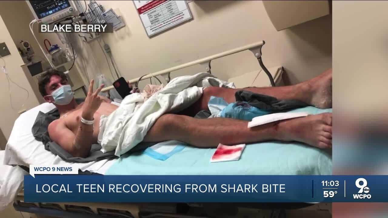 Northern Kentucky teen bit by shark on spring break says he'll return to ocean