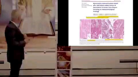 dr mccoullough more vaxxine deaths