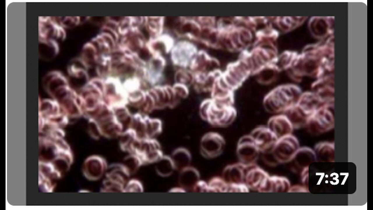 Live Blood Analysis with ClO2. Chlorine Dioxide Therapy. AndreasKalcker.com