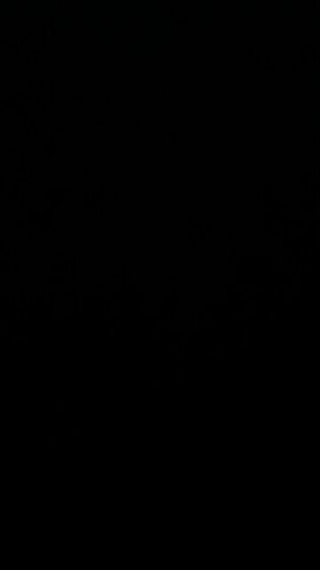 Restless leg syndrome