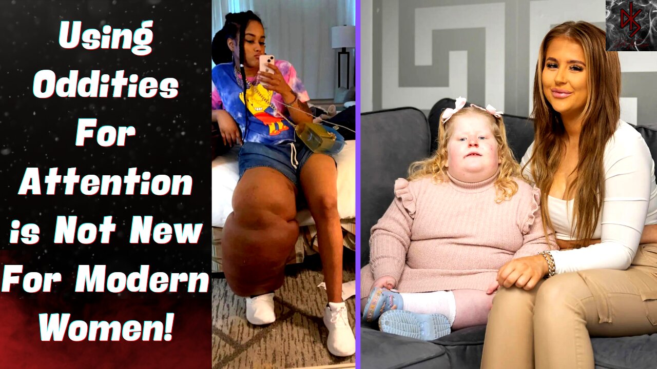 One Woman Has a 100 Pound Leg, the Other a 100 Pound Toddler, the Lengths Women Go to For Attention!