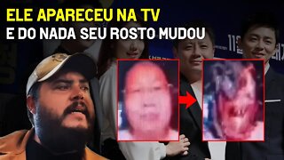 Ele apareceu na TV e do nada seu rosto mudou