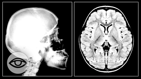 Project MK-ULTRA: Illegal Mind Control Experiments