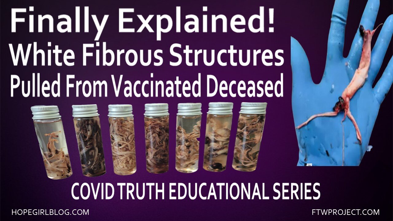 Finally Explained! White Fibrous Clots From Vaccinated Deceased