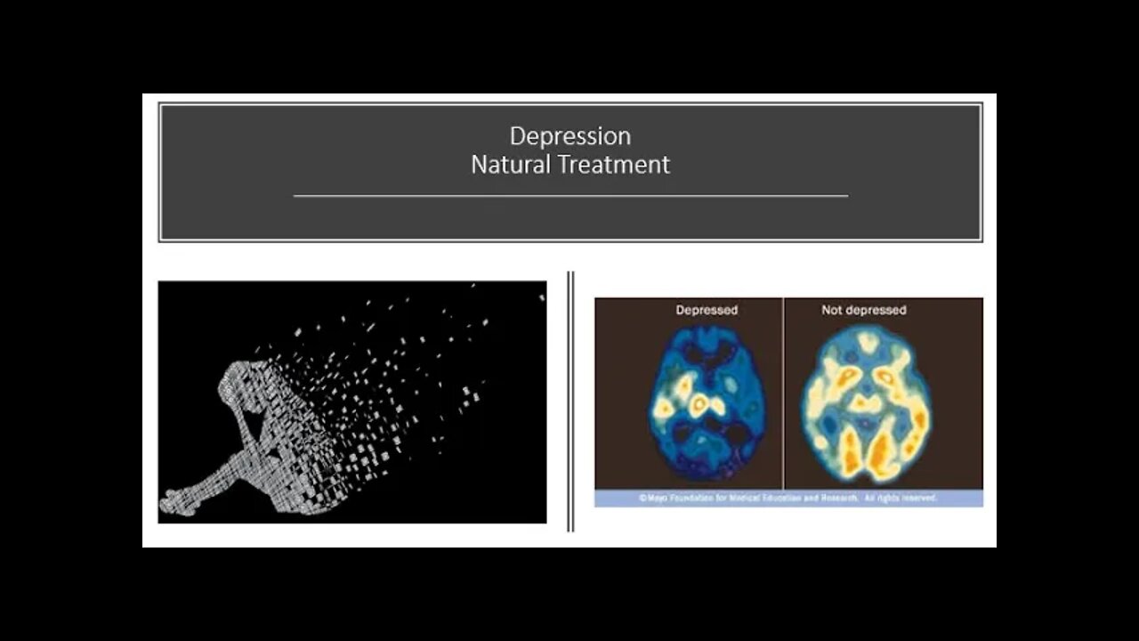 Depression - Natural Treatment