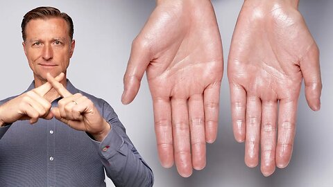 How to Stop Excessive Sweating (Hyperhidrosis)