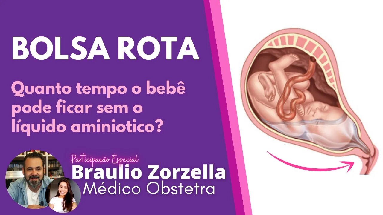 BOLSA ROTA | Quanto tempo o bebê pode ficar na barriga sem líquido? Braulio Zorzella - Boa Gravidez