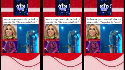 Joelma aparece com rosto inchado e fãs ficam preocupados