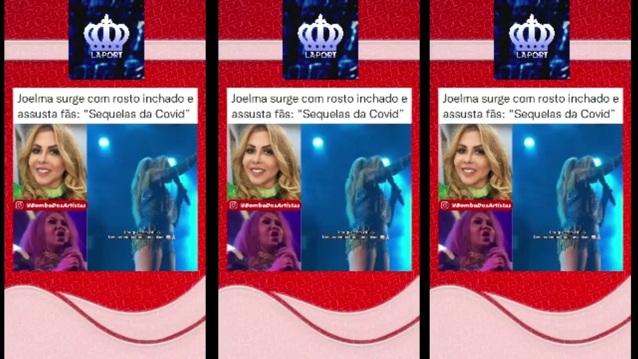 Joelma aparece com rosto inchado e fãs ficam preocupados