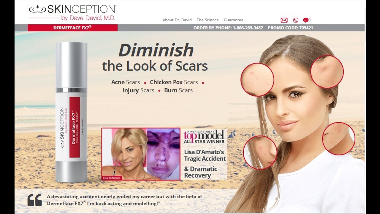 HOW I GET RID MY ACNE SCARS