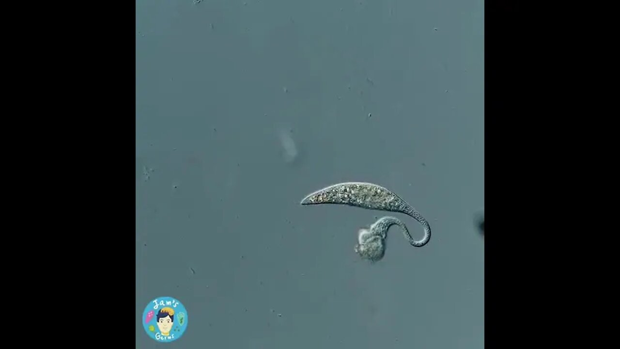 Vicious microscopic hunter, the single cell organism, Lacrymaria olor, attacking and hunting another