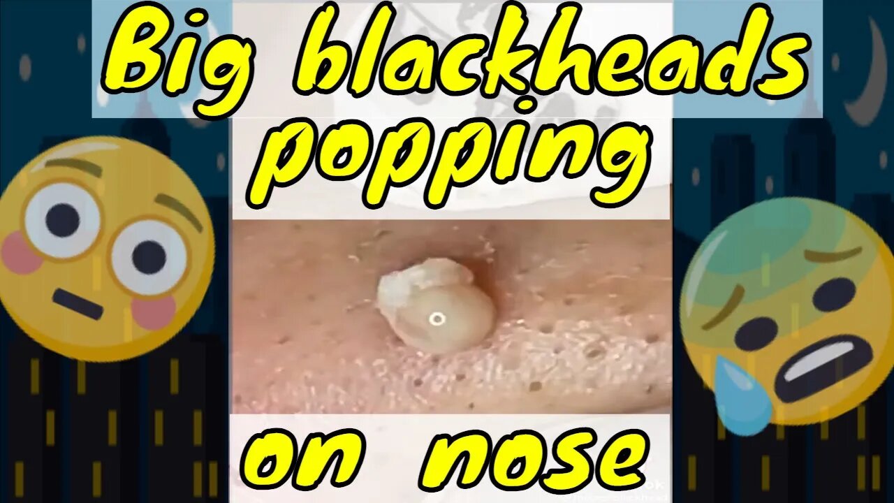 Big blackheads popping on nose 🫣🪱 #blackheadremoval #blackhead #blackheads #satisfyingvideos