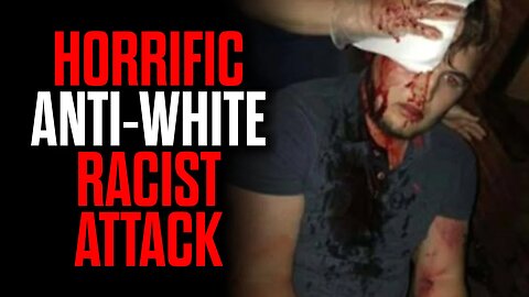 Horrific Anti-White Racist Attack