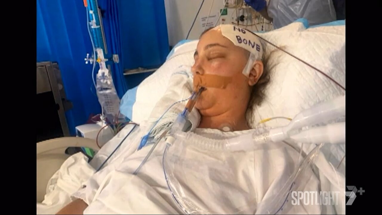 Who suffered from the vaccines?