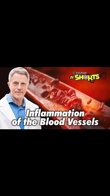 #SHORTS Inflammation of the Blood Vessels