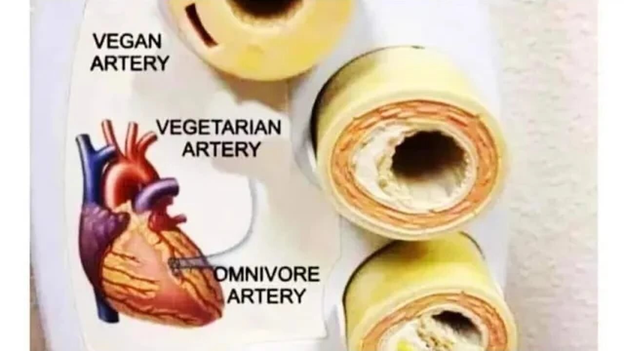 MEAT DON'T CAUSE CALCIFIED ARTERIES | WHY THEY SPREAD MISINFORMATION WITH NO PROOF