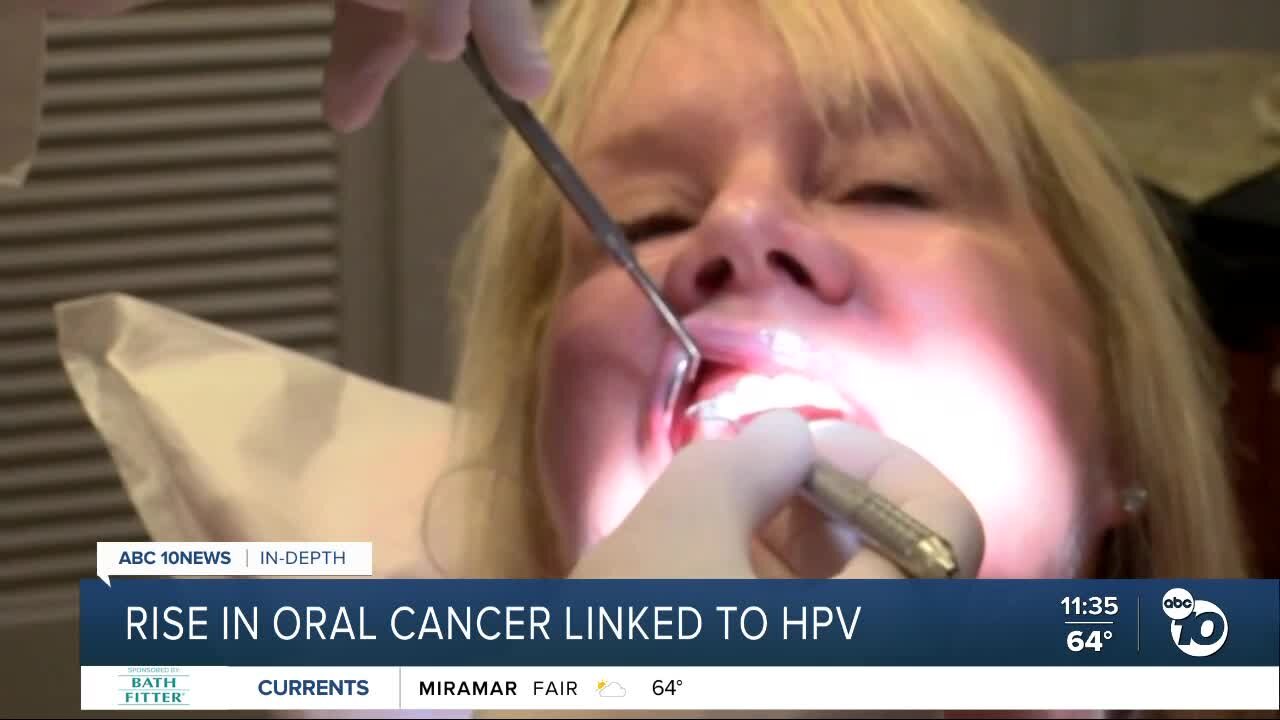 Rise in oral cancer linked to HPV