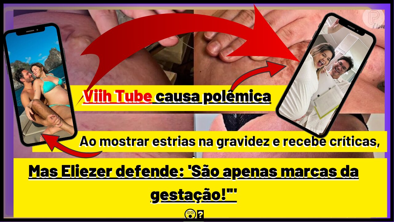 #viihtube causa polêmica ao mostrar estrias na gravidez e recebe críticas, mas #eliezer defende' 💖👌