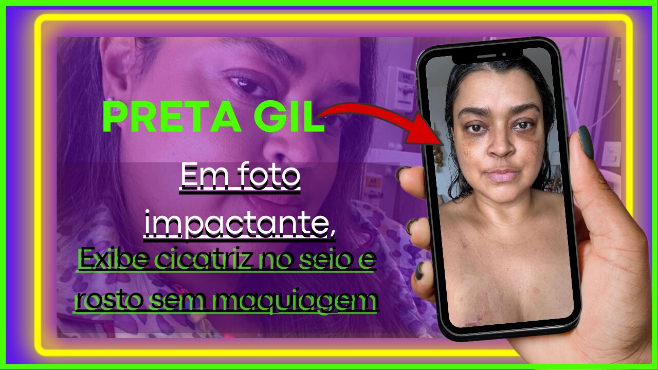 A verdadeira face da coragem #pretagil compartilha foto sem maquiagem e cicatriz Sigamos nossas luta