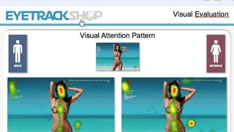 우리가 알아야할 튼살 96가지 남자의 눈길이 가는 입술 다리 가슴 st침 튼살침치료 자향미한의원