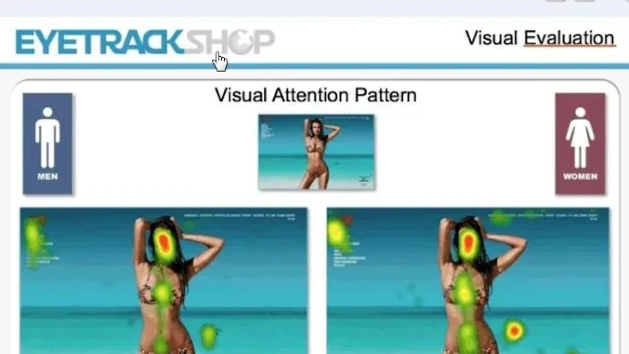 우리가 알아야할 튼살 96가지 남자의 눈길이 가는 입술 다리 가슴 st침 튼살침치료 자향미한의원