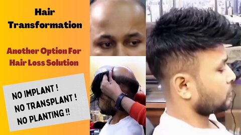 Hair Transformation - Hair Patch for Hair Loss Solution.