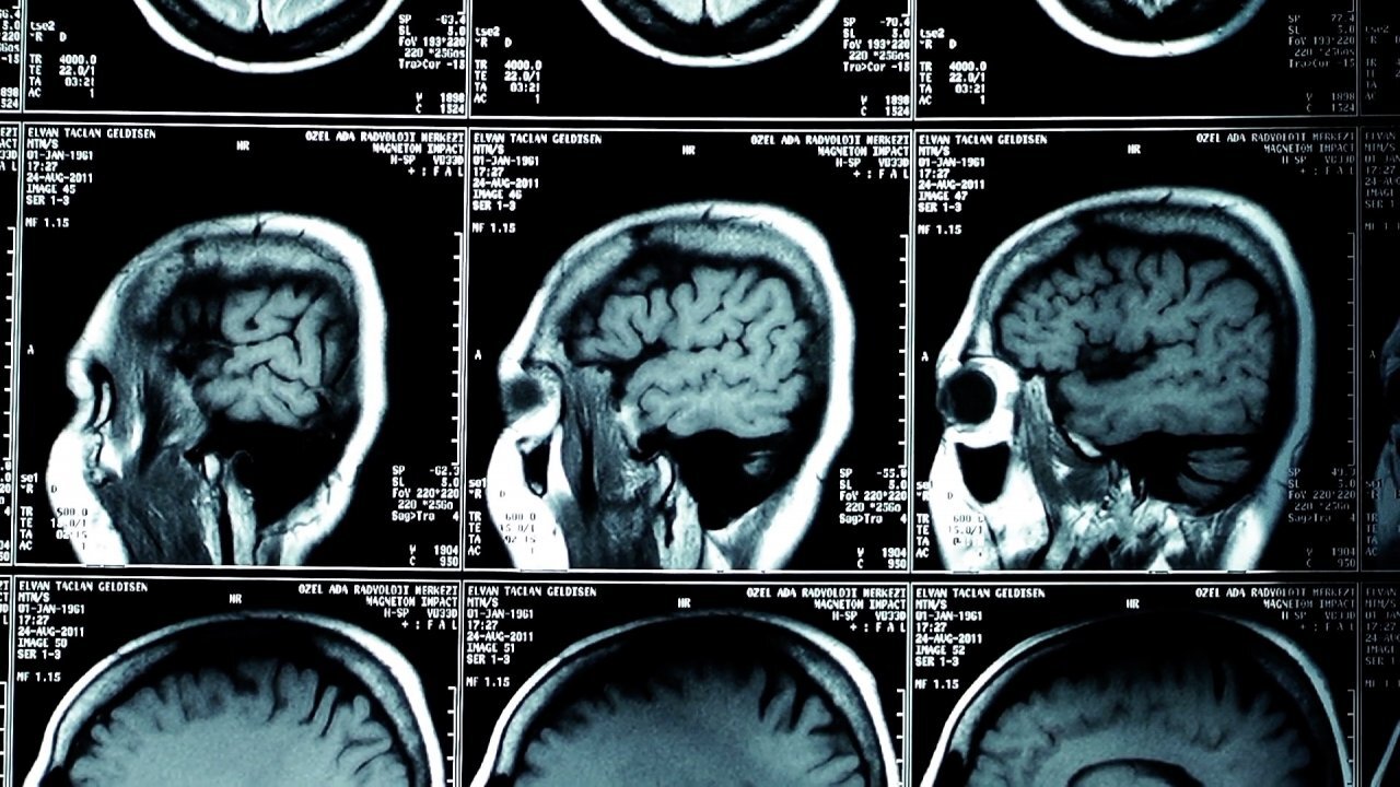 Experts Warn: Medical Bills Could Increase Due To Inflation