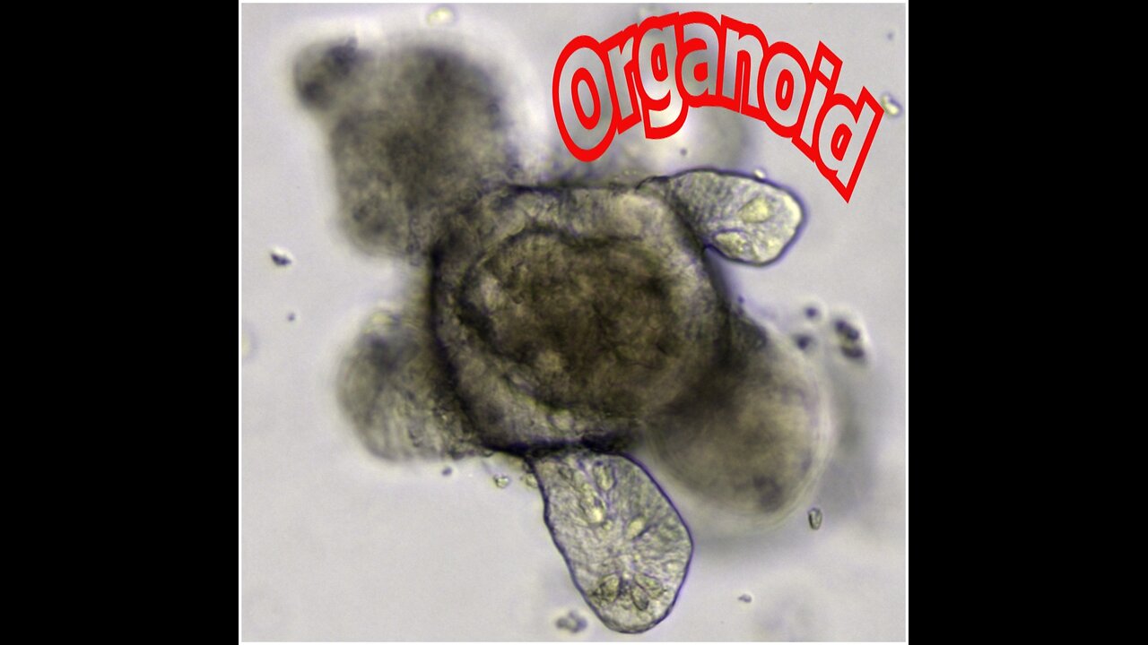 Organoids