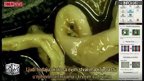 SUDDEN DEATH - FROM WHAT