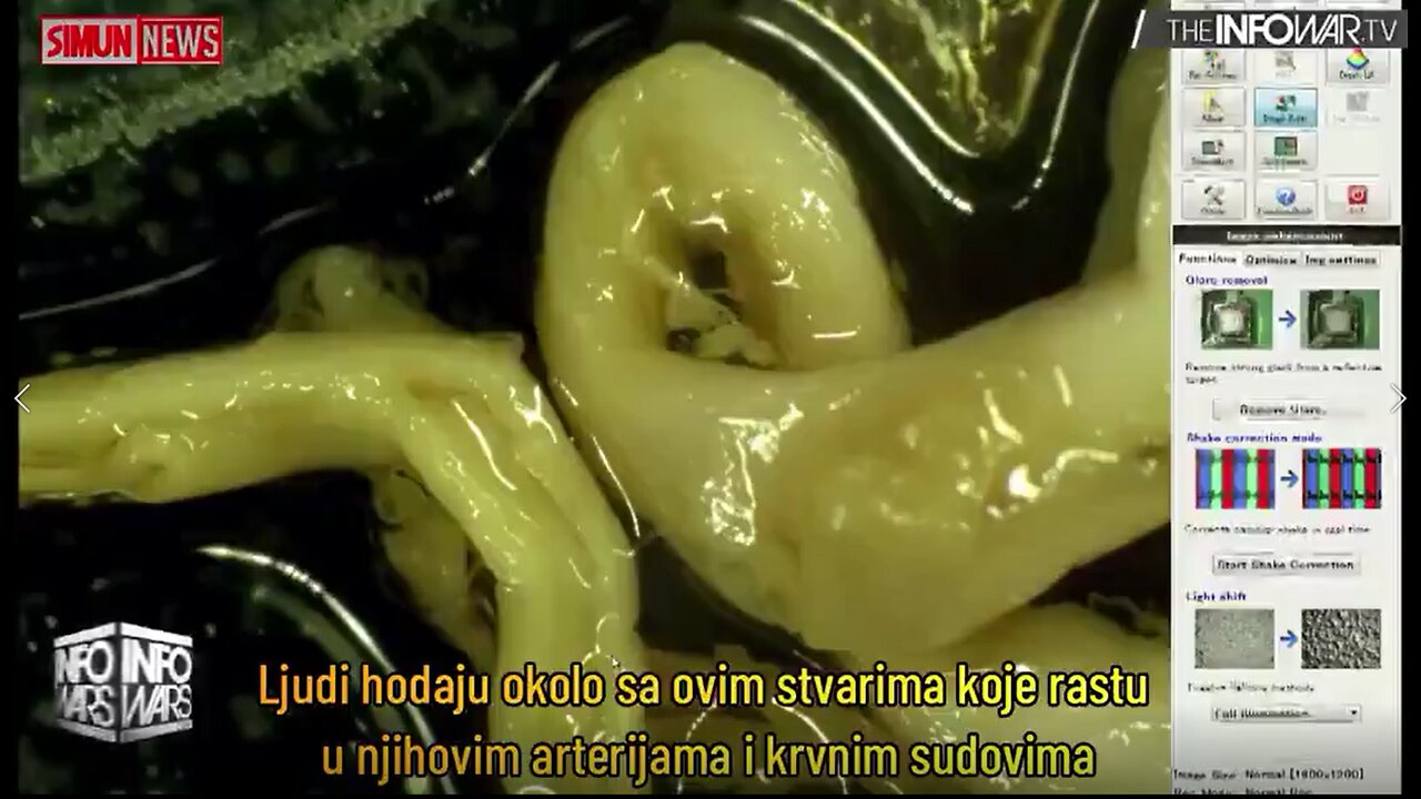 SUDDEN DEATH - FROM WHAT