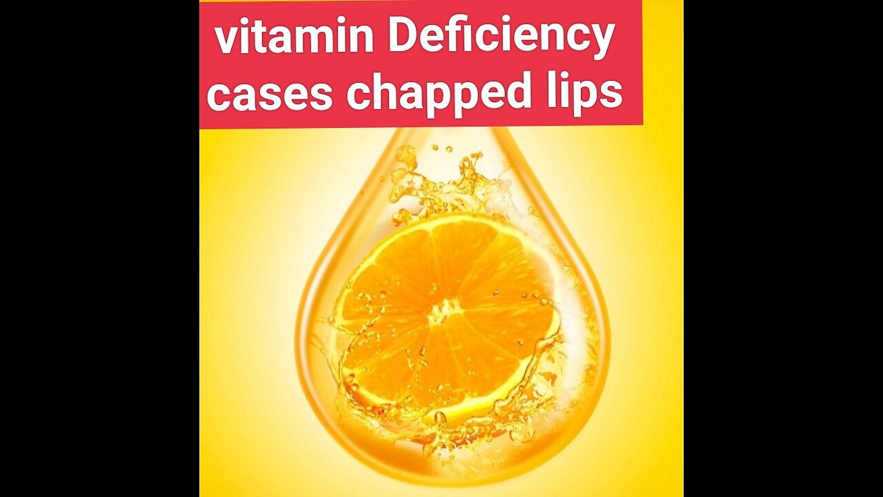 Which vitamin deficiency cases chapped lips