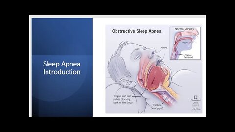 Sleep Apnea Introduction