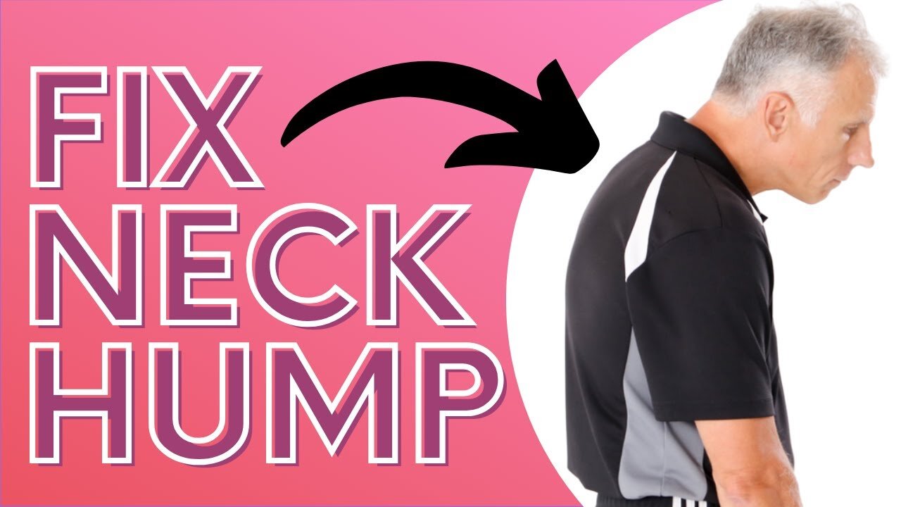 How You Can Get Rid of Neck Hump With a SOCK. Dowager's Hump.