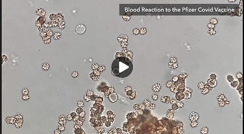 Watch COVID Shot Juice Attack Human Blood In Real Time