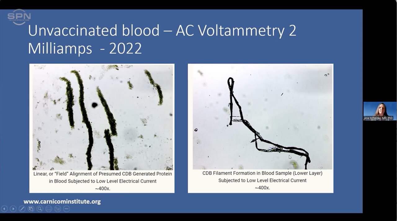 Dr. Ana Mihalcea - WORLD FIRST! Spectrometry of Nano Structures in the Blood