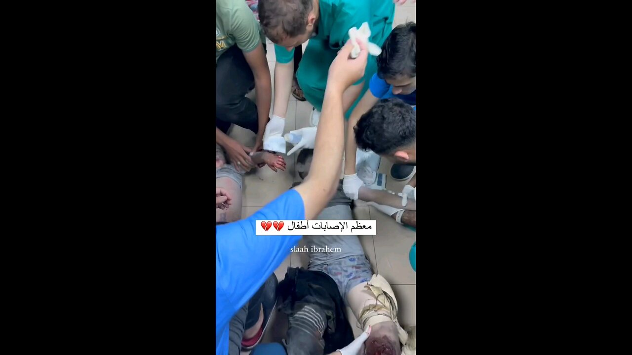 🔴 مشاهد قاسية.. إصابات في صفوف الأطفال جراء قصف طائرات الاحتلال منزلاً في مخيم البريج وسط القطاع