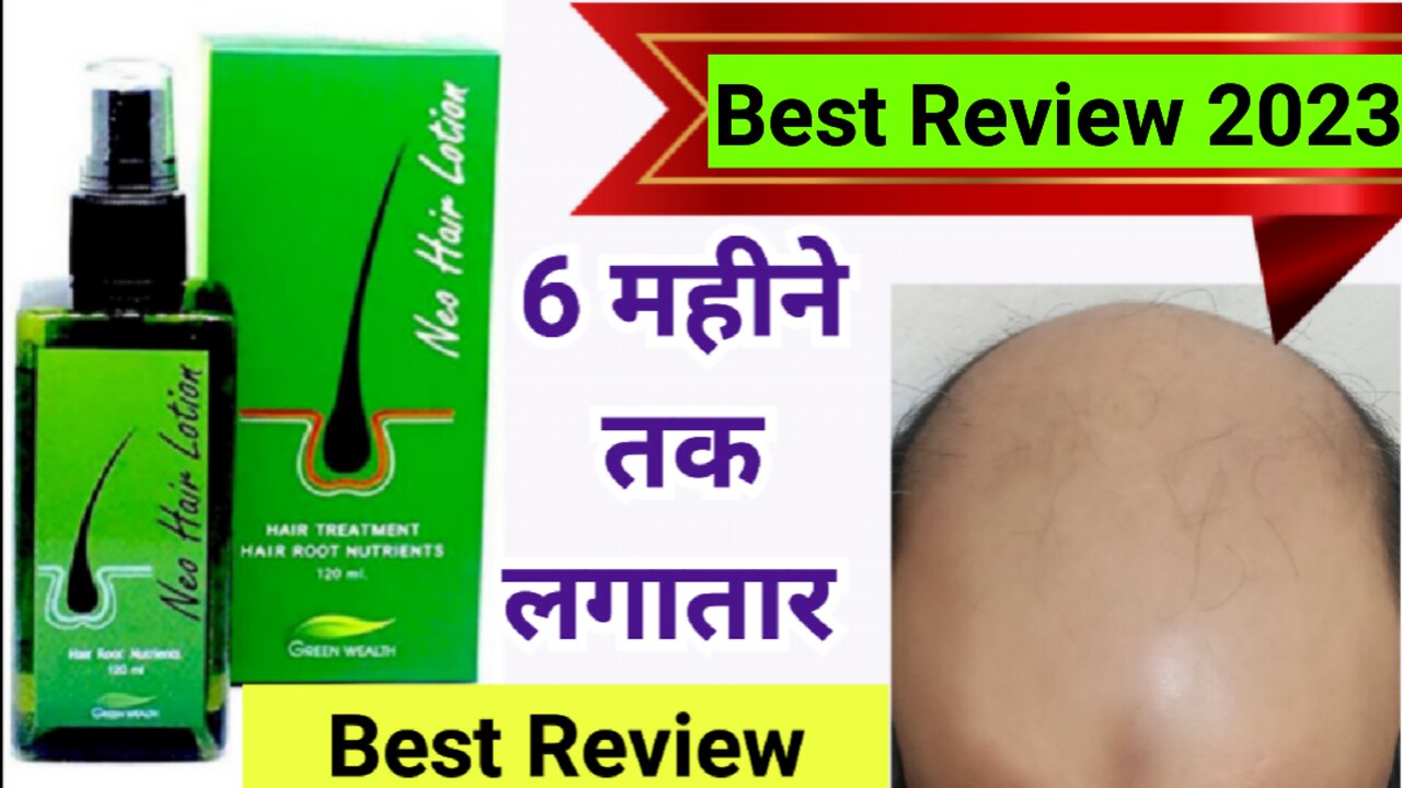 Neo Hair Lotion Best Review 2023