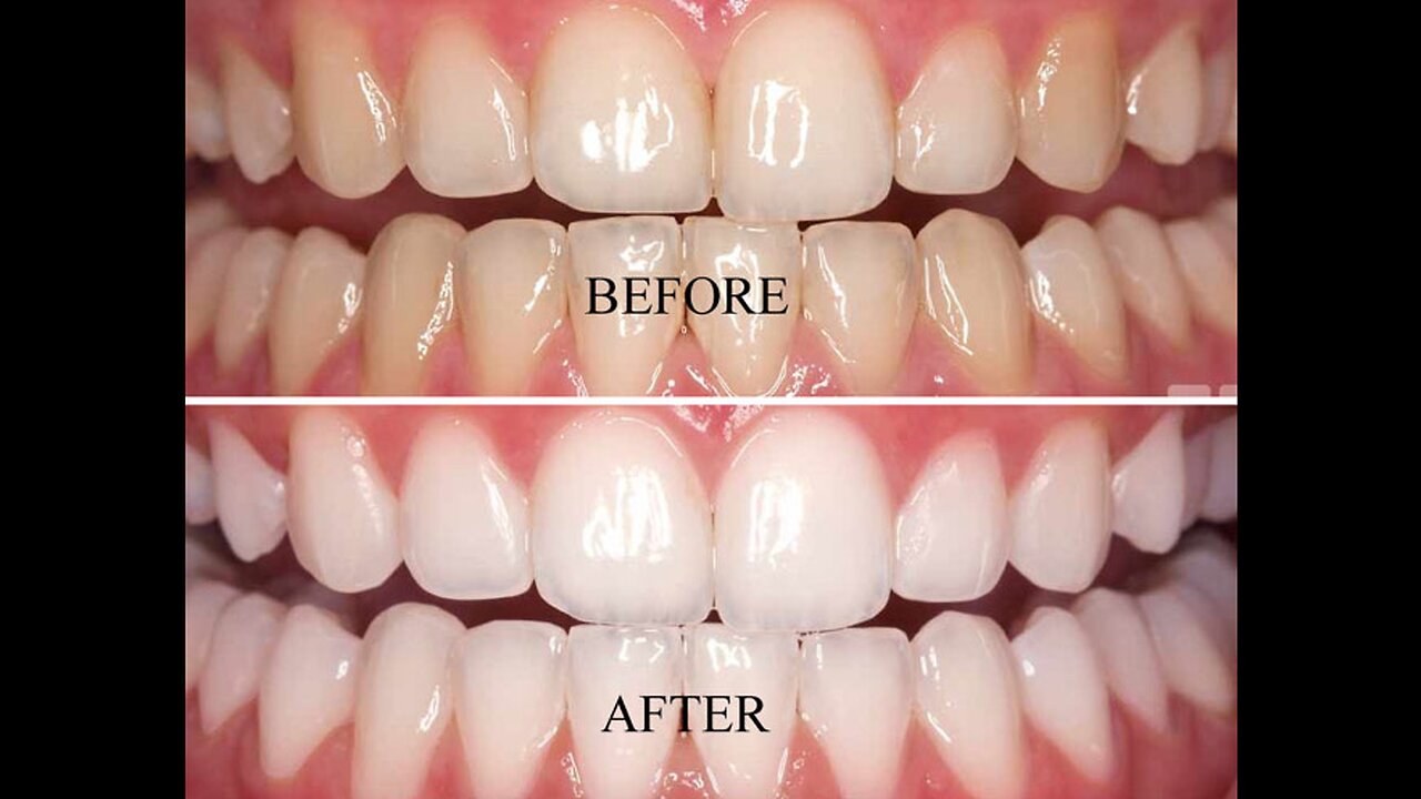 The Best Solution For Teeth and Gum Disease!!