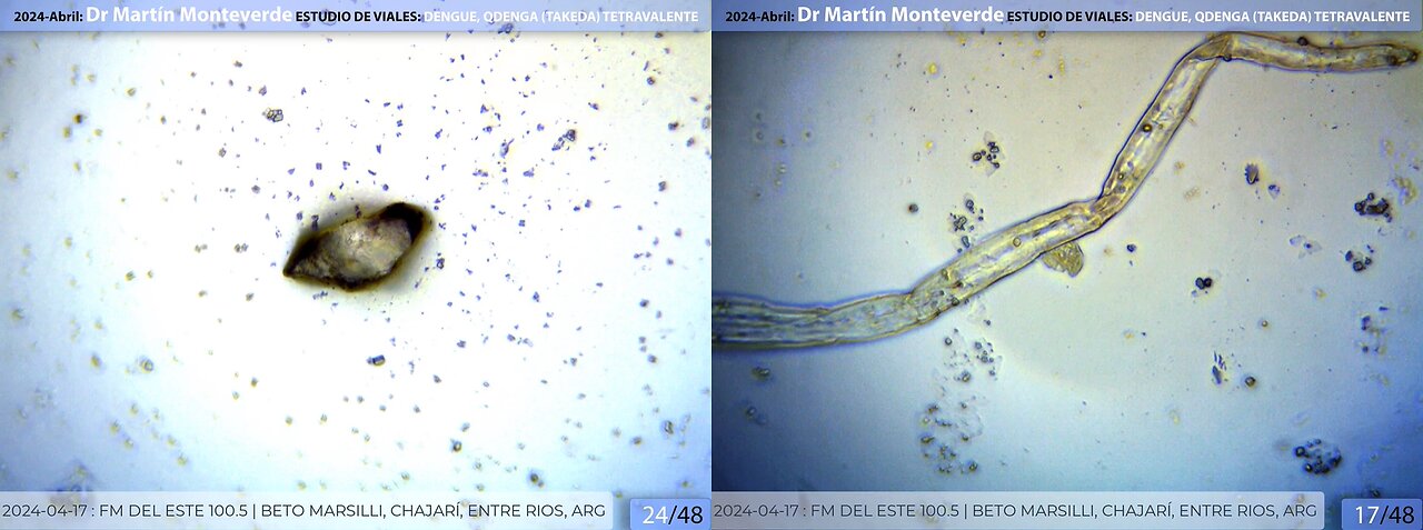 Dr. Martín Monteverde - estudio de viales Dengue, QDENGA (TAKEDA) tetravalente 💉💉💉 ｜ Abril 2024