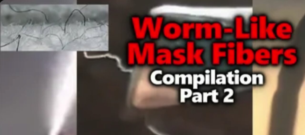 Mask Worms？ Parasites？ Morgellons？ Moving Black Mystery Thread Compilation Part 2