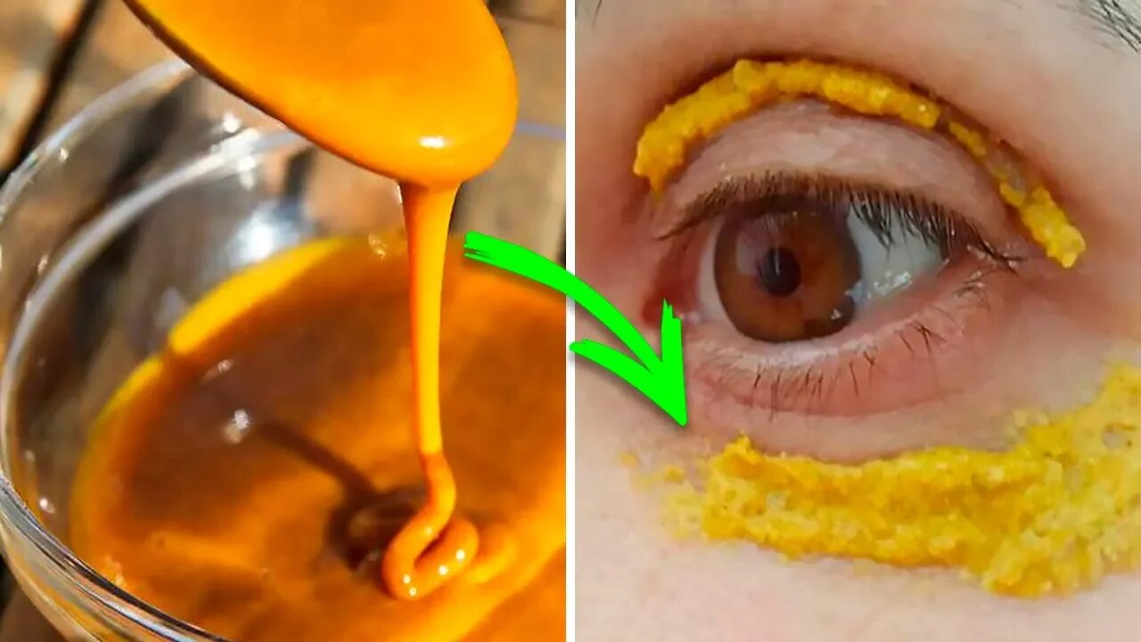 Say Goodbye To Dark Circles With Turmeric!