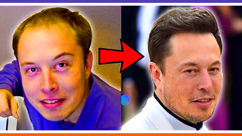 Origins of Elon Musk's Hairline