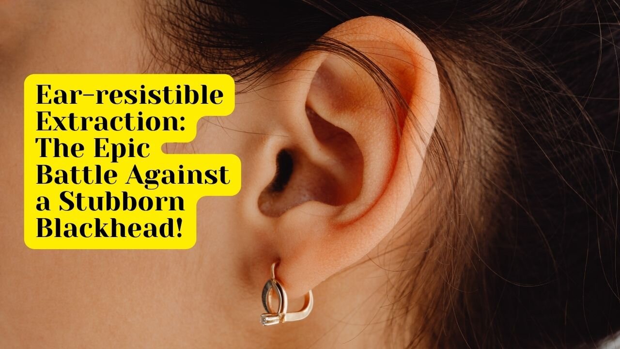 Ear-resistible Extraction: The Epic Battle Against a Stubborn Blackhead!