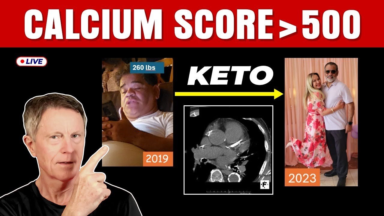 How To Do Keto To Burn Fat, Reverse Fatty Liver & Unclog Arteries