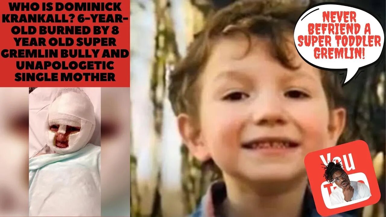 Dominick Krankall 6 Year Old Burned by 8 year old Gremlin Bully and Unapologetic Single Mother