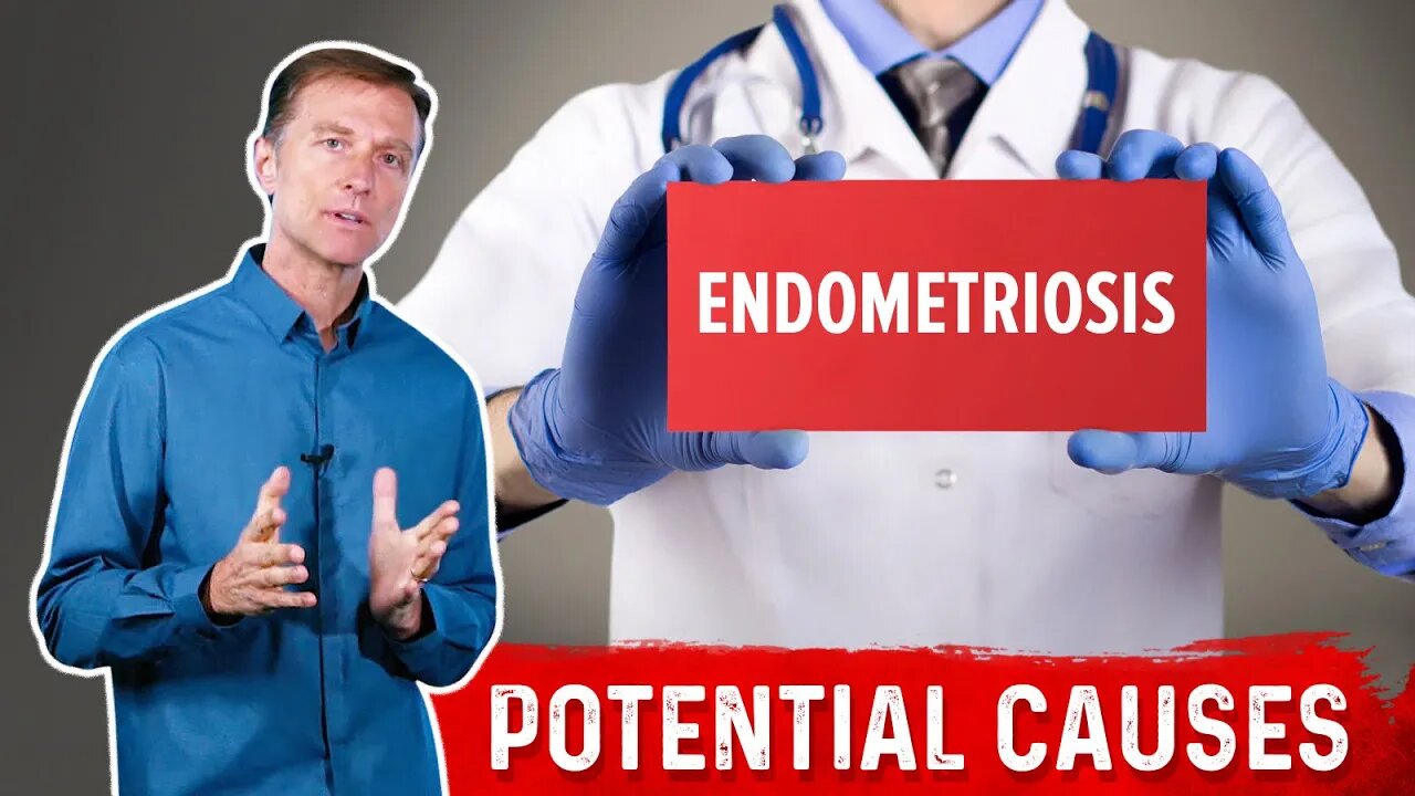 What Causes Endometriosis?